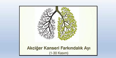 ‘Akciğer Kanserinde En Önemli Risk Faktörü Tütün ve Tütün Ürünleridir’